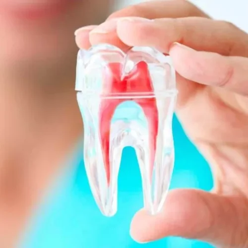 Endodontia-1200x675-1-1024x576